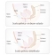 PELVIX CONCEPT.TRATAMIENTO DE SUELO PELVICO,RECOMENDADAS POR GINECÓLOGOS POSTPARTO