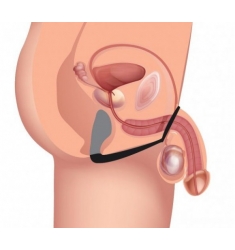 ANILLO PARA EL PENE CON ESTIMULADOR PROSTÁTICO 